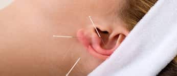 acupunctuur-auriculotherapie