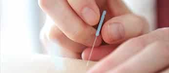 acupunctuurpraktijk-acupunctuur